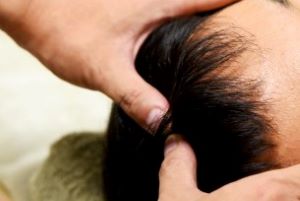 頭皮のケア